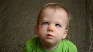 Physical Deformities from Diseases