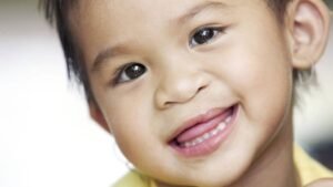 Rare Health Conditions