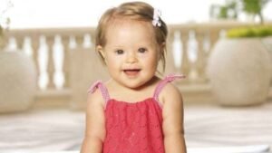 Physical Deformities from Diseases