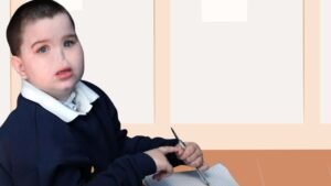 Physical Deformities from Diseases